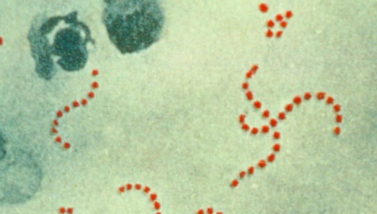 Imagen del 'Streptococcus Pyogenes'