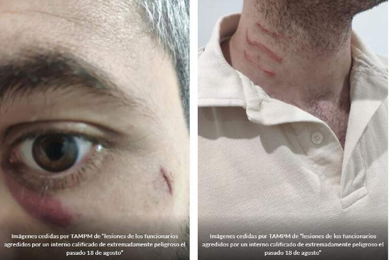 Imatges cedides per TAMPM de 'lesions dels funcionaris agredits per un intern qualificat d'extremadament perillós el passat 18 d'agost'