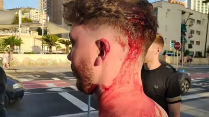 El jove britànic després de la pallissa