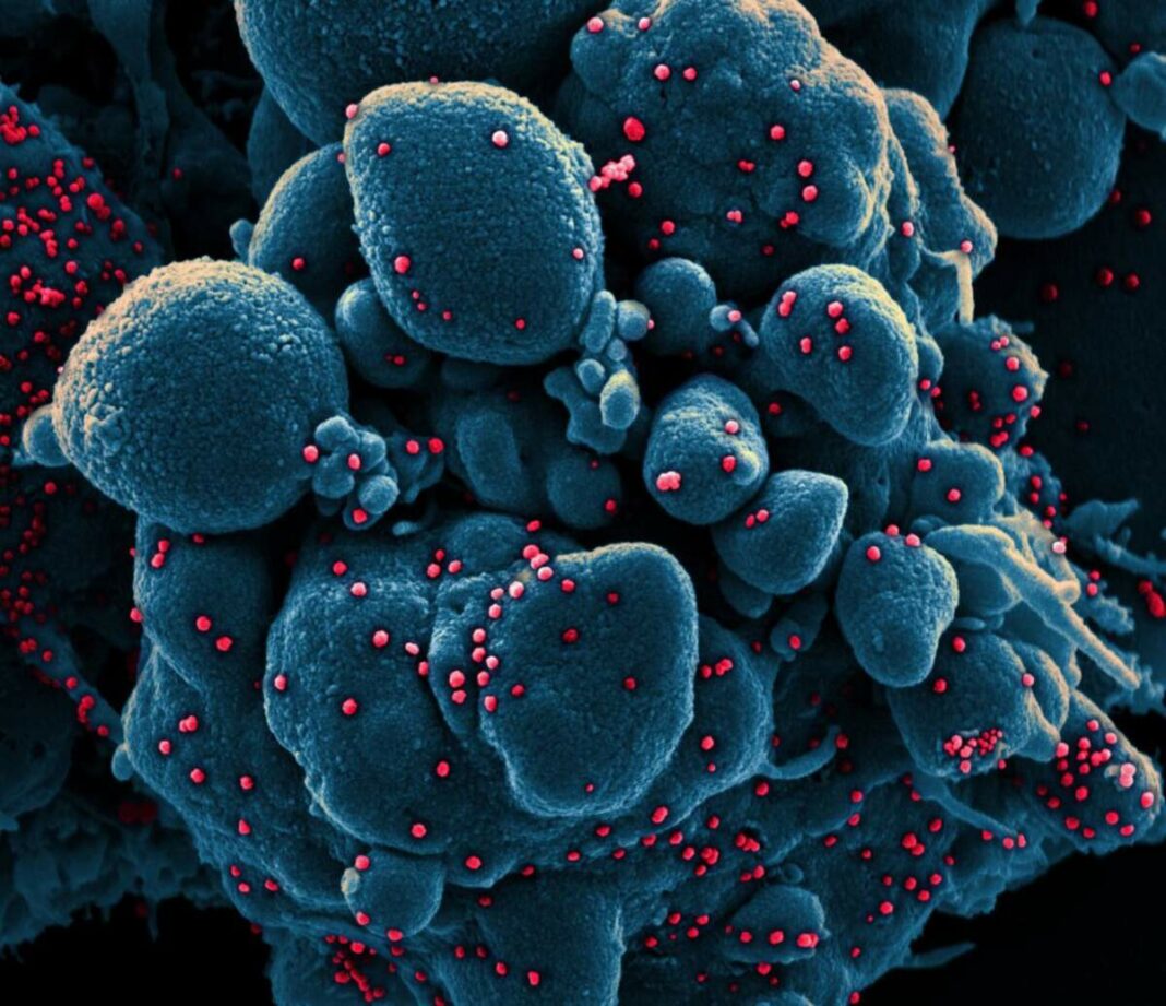 Foto real del coronavirus baix el microscopi