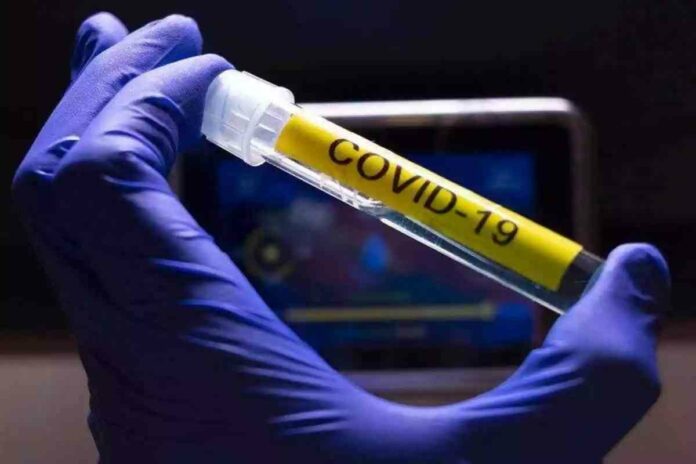 Imatge d'arxiu d'una mostra de laboratori de Covid-19