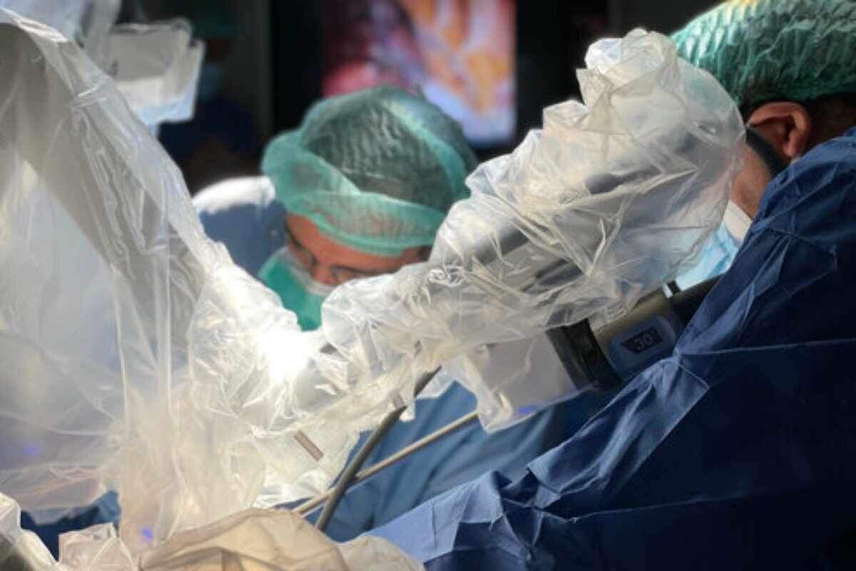 Bellvitge fa la primera extracció al món d'una primera costella amb cirurgia robòtica i una sola incisió