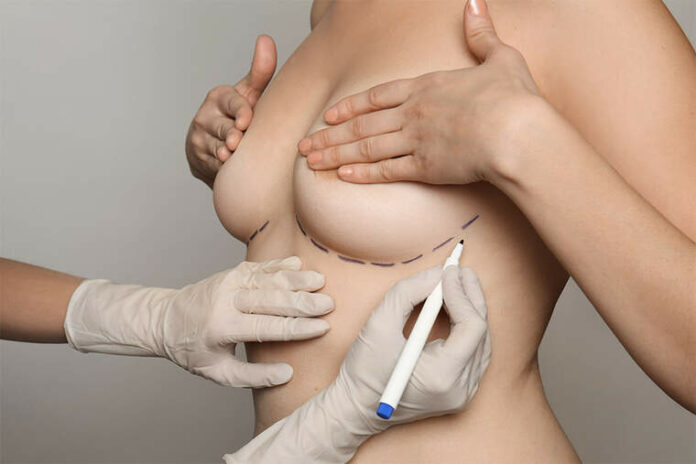 operació estètica d'augment de pits