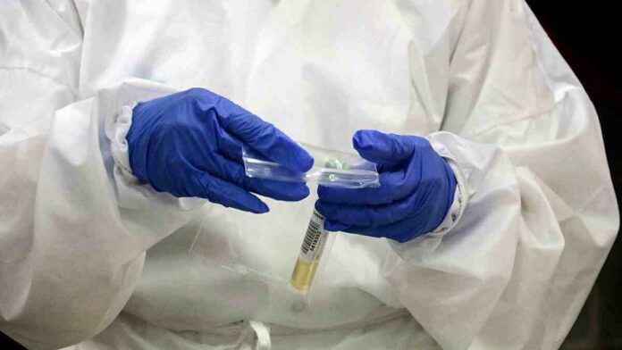 Pla detall d'unes de les mostres per a PCR