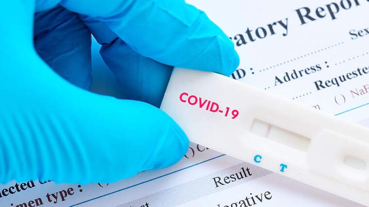 Espanya va haver de tornar a comprar tests ràpids pel coronavirus