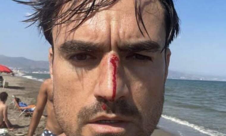 Un jove sofreix una agressió homòfoba en una platja canina de Màlaga